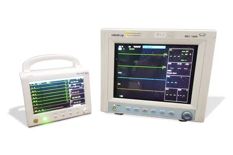 Patient Monitor